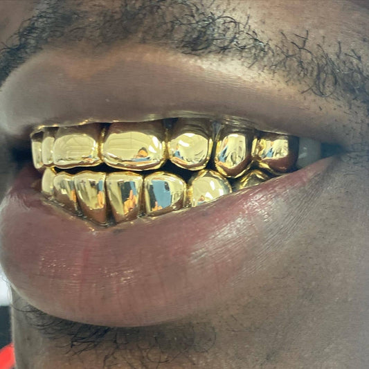 10k Real Gold Grillz